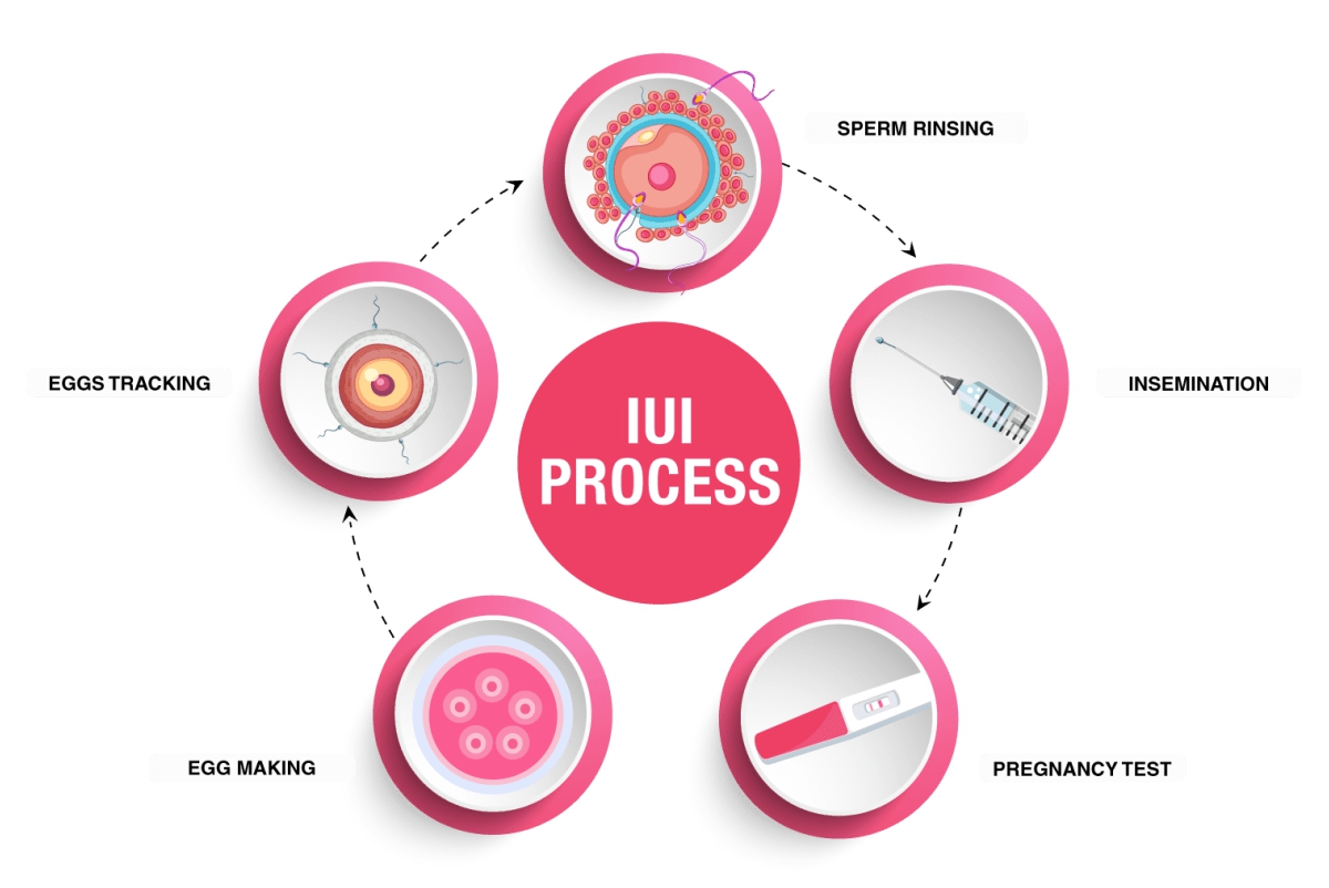 IUI.jpg